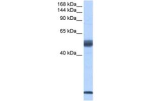 Western Blotting (WB) image for anti-Pre-mRNA Branch Site Protein p14 (SF3B14) antibody (ABIN2462263) (Pre-mRNA Branch Site Protein p14 (SF3B14) Antikörper)