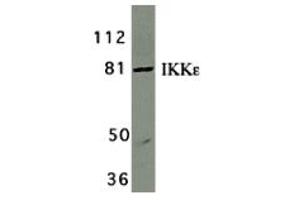 Western Blotting (WB) image for anti-Inhibitor of kappa Light Polypeptide Gene Enhancer in B-Cells, Kinase epsilon (IKBKE) (C-Term) antibody (ABIN1030432)