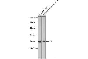 Western blot analysis of extracts of various cell lines using AK1 Polyclonal Antibody at dilution of 1:1000. (Adenylate Kinase 1 Antikörper)