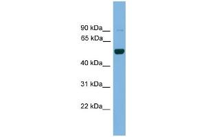 WB Suggested Anti-Irx2 Antibody Titration: 0. (IRX2 Antikörper  (Middle Region))