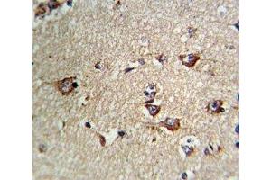 Immunohistochemistry (IHC) image for anti-Transferrin Receptor (p90, CD71) (TFRC) (AA 649-677) antibody (ABIN3029214)