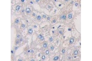 IHC-P analysis of Human Tissue, with DAB staining. (IL-6 Receptor Antikörper  (AA 216-356))