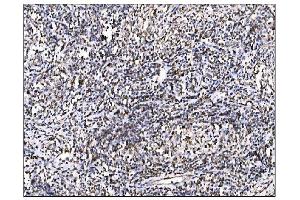 IHC analysis of Ornithine Aminotransferase/OAT using anti-Ornithine Aminotransferase/OAT antibody (ABIN7600649). (OAT Antikörper  (AA 214-439))