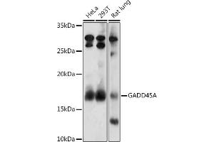 Western blot analysis of extracts of various cell lines, using GA antibody (ABIN3022563, ABIN3022564, ABIN3022565, ABIN1679943 and ABIN6218905) at 1:1000 dilution.