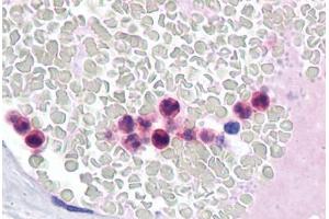 Human Neutrophils: Formalin-Fixed, Paraffin-Embedded (FFPE) (IRF4 Antikörper  (AA 342-452))