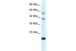 Human heart; WB Suggested Anti-CGI-143 Antibody Titration: 0. (BOLA1 Antikörper  (N-Term))