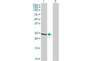 Western Blot analysis of TCEAL1 expression in transfected 293T cell line by TCEAL1 monoclonal antibody (M20), clone 2B5. (TCEAL1 Antikörper  (AA 1-100))