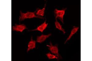 ABIN6274600 staining HepG2 by IF/ICC. (CDH19 Antikörper  (Internal Region))