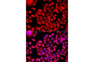 Immunofluorescence analysis of A549 cell using MTHFD1L antibody. (MTHFD1L Antikörper)