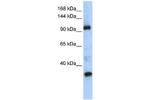 Western Blotting (WB) image for anti-Terminal Uridylyl Transferase 1, U6 SnRNA-Specific (TUT1) antibody (ABIN2458418) (TUT1 Antikörper)