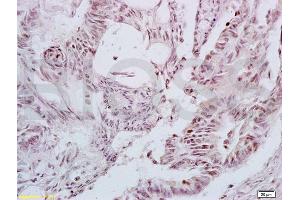 Immunohistochemistry (IHC) image for anti-Lymphoid Enhancer-Binding Factor 1 (LEF1) (AA 331-399) antibody (ABIN735248)