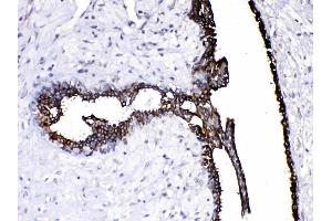 Immunohistochemistry (IHC) image for anti-Caspase 8 (CASP8) (AA 410-449), (N-Term) antibody (ABIN4886501)
