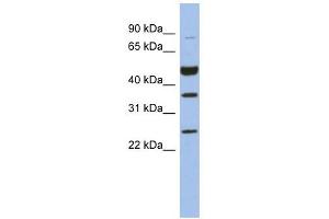 MAGEB3 antibody used at 1 ug/ml to detect target protein. (MAGEB3 Antikörper  (N-Term))