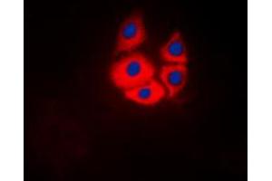 Immunofluorescent analysis of MARK4 staining in Jurkat cells. (MARK4 Antikörper  (Center))