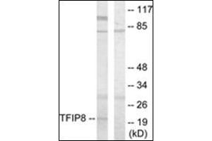 Western blot analysis of extracts from HuvEc cells using TFIP8 Antibody .