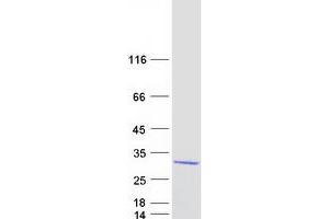 Western Blotting (WB) image for SAR1 Homolog B (SAR1B) (Transcript Variant 1) protein (Myc-DYKDDDDK Tag) (ABIN2731399)