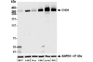 anti-Chromodomain Helicase DNA Binding Protein 4 (CHD4) antibody