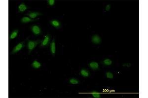 Immunofluorescence of monoclonal antibody to CASP9 on HeLa cell.