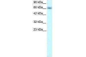Human Raji; WB Suggested Anti-TRAFD1 Antibody Titration: 0. (TRAFD1 Antikörper  (C-Term))