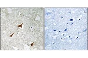 Immunohistochemistry analysis of paraffin-embedded human brain, using p19 INK4d Antibody. (CDKN2D Antikörper  (AA 96-145))