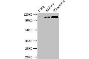 Western Blot Positive WB detected in: Mouse lung tissue, Mouse kidney tissue, Human placenta tissue All lanes: MSH4 antibody at 3 μg/mL Secondary Goat polyclonal to rabbit IgG at 1/50000 dilution Predicted band size: 105 kDa Observed band size: 105 kDa (MSH4 Antikörper  (AA 501-800))