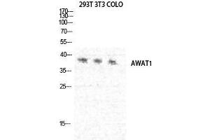 Western Blot (WB) analysis of 293T NIH-3T3 COLO205 cells using DGAT2L3 Polyclonal Antibody.