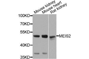 Western blot analysis of extracts of various cells, using MEIS2 antibody. (MEIS2 Antikörper)