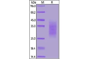 Biotinylated Human  RII, His,Avitag on  under reducing (R) condition. (TGFBR2 Protein (AA 23-159) (His tag,AVI tag,Biotin))