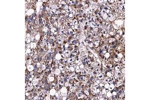 IHC analysis of TTC7B using anti-TTC7B antibody (ABIN7601050). (TTC7B Antikörper  (AA 275-730))