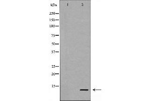 Western blot analysis of Caspase 9 (Cleaved-Asp353) expression in NIH/3T3 cells treated with etoposide,The lane on the left is treated with the antigen-specific peptide. (Caspase 9 Antikörper  (Cleaved-Asp353))