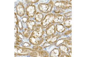 Immunohistochemistry of paraffin-embedded rat kidney using RPL13 Rabbit mAb (ABIN7269993) at dilution of 1:50 (40x lens). (RPL13 Antikörper)