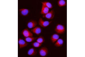 IF analysis of IFT43 using anti-IFT43 antibody (ABIN7599083). (IFT43 Antikörper  (AA 1-208))
