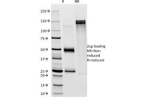 SDS-PAGE Analysis Purified CD28 Mouse Monoclonal Antibody (C28/76). (CD28 Antikörper)