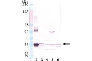 Western blot analysis of HO-2, pAb: Lane 1: MW marker, Lane 2: HO-2 Recombinant Human Protein , Lane 3: Human Liver Microsome Extract, Lane 4: Mouse Liver Microsome Extract, Lane 5: Rat Liver Microsome Extract, Lane 6: Dog Liver Microsome Extract. (HMOX2 Antikörper  (N-Term))