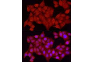Immunofluorescence analysis of HeLa cells using [KO Validated] PTPN2 Rabbit pAb (ABIN3022584, ABIN3022585, ABIN3022586, ABIN1513448 and ABIN6218927) at dilution of 1:250 (40x lens). (PTPN2 Antikörper  (AA 1-353))