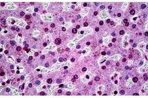 Human Liver: Formalin-Fixed, Paraffin-Embedded (FFPE) (SGK1 Antikörper  (AA 1-91))