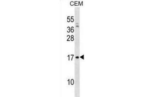 Western Blotting (WB) image for anti-Pre-B Lymphocyte 1 (VPREB1) antibody (ABIN3000848) (VPREB1 Antikörper)