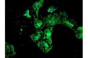 Anti-PSMB9 mouse monoclonal antibody (ABIN2455595) immunofluorescent staining of COS7 cells transiently transfected by pCMV6-ENTRY PSMB9 (RC209001). (PSMB9 Antikörper  (AA 21-219))