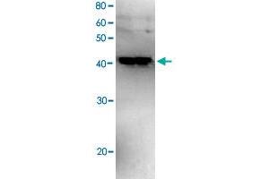 Western blot analysis of recombinant Polb with Polb polyclonal antibody . (POLB Antikörper)