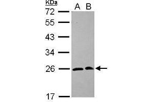 WB Image Sample (30 ug of whole cell lysate) A: 293T B: A431 12% SDS PAGE antibody diluted at 1:1000