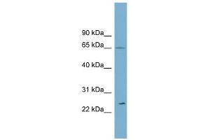 Ribophorin II antibody used at 1 ug/ml to detect target protein. (Ribophorin II Antikörper  (Middle Region))
