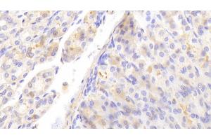 Immunohistochemistry (IHC) image for anti-serpin Peptidase Inhibitor, Clade F (Alpha-2 Antiplasmin, Pigment Epithelium Derived Factor), Member 1 (SERPINF1) (AA 19-417) antibody (ABIN7434440)