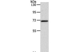 Western Blot analysis of Mouse liver tissue using SOX-13 Polyclonal Antibody at dilution of 1:800 (SOX13 Antikörper)