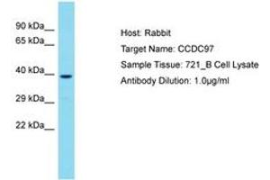 Image no. 1 for anti-Coiled-Coil Domain Containing 97 (CCDC97) (C-Term) antibody (ABIN6750718) (CCDC97 Antikörper  (C-Term))