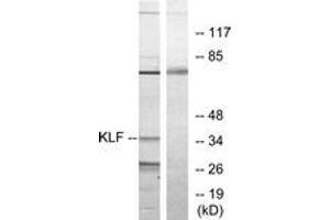 Western blot analysis of extracts from Jurkat cells, treated with serum 20% 15', using KLF Antibody.