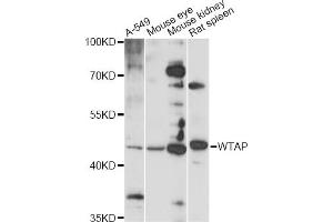 Western blot analysis of extracts of various cell lines, using WTAP antibody (ABIN6291068) at 1:1000 dilution. (WTAP Antikörper)