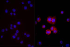 Human pancreatic carcinoma cell line MIA PaCa-2 was stained with Mouse Anti-Human CD44-UNLB, and DAPI. (Esel anti-Maus IgG (Heavy & Light Chain) Antikörper (Biotin) - Preadsorbed)