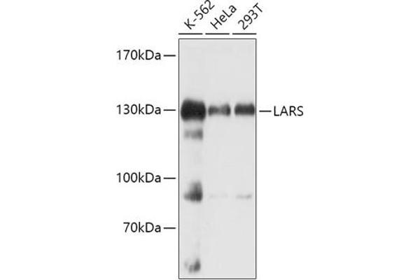 LARS Antikörper  (AA 1-270)