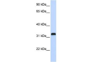 WB Suggested Anti-C21orf62 Antibody Titration:  0. (C21orf62 Antikörper  (Middle Region))