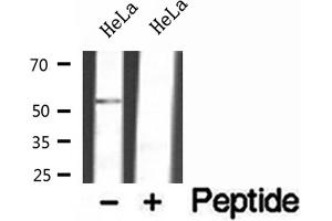 Western blot analysis of extracts of HeLa cells, using FAF2 antibody. (FAF2 Antikörper  (Internal Region))